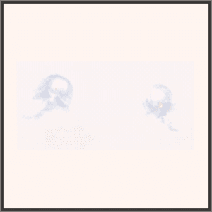 夢の囁き＜耳＞