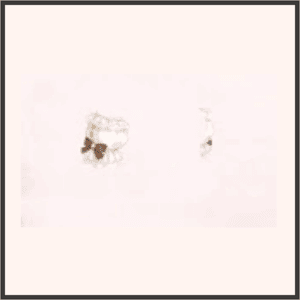 松ぼっくりパフスリーブ