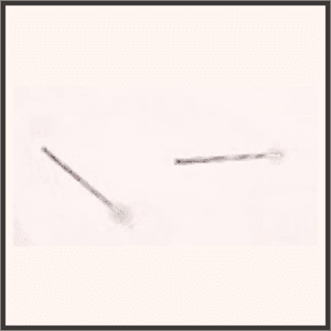 血色のnスティック